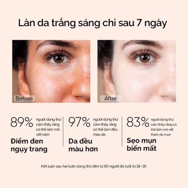 SKINTIFIC Combo Glowing Basic 2PCS: Serum Niacinamide + Vitamin C + Kem Dưỡng 5X - Da Sáng Mịn, Dưỡng ẩm 5 Lần
