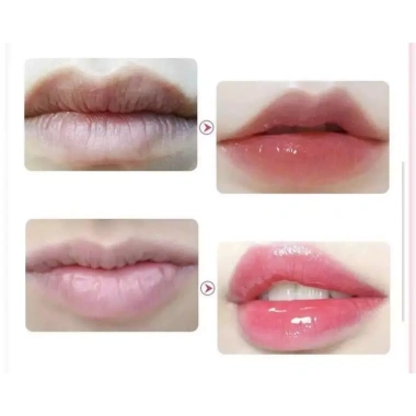Son dưỡng filler môi RVB LAB - Bí quyết đôi môi căng mọng, giảm giá 22% chỉ 780.000đ 7 Son dưỡng filler môi RVB LAB - Bí quyết đôi môi căng mọng, giảm giá 22% chỉ 780.000đ 7