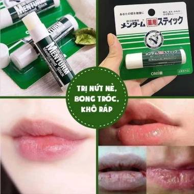Son Dưỡng OMI Menturm 4g Nhật Bản Chống Khô Nứt Nẻ Dưỡng ẩm Sâu Giá Giảm 37.000₫ 5