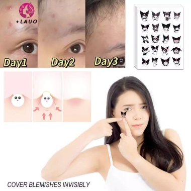 Springevenstar 100 miếng dán mụn Sanrio Kuromi - Miếng dán vô hình giảm mụn, chăm sóc da, giá 44.220 VND 2