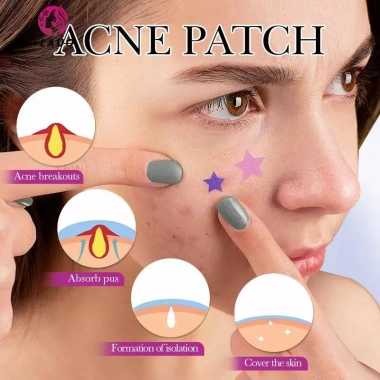 Springevenstar 1Box 32 miếng dán mụn vô hình 4 màu sửa phai màu, công cụ trang điểm ngôi sao có gương 5