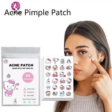 Springevenstar 96 miếng dán Hello Kitty Chữa mụn, phai màu nhám, mặt, đóng mụn