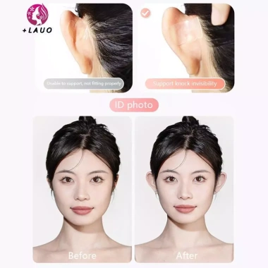 Springevenstar Ear Corrector 12/30 - Hộp Elf Ear Stiers Tự Dính Vô Hình, Giá 28.100₫ 4