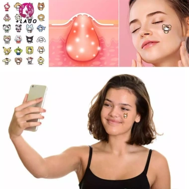 Springevenstar Miếng Dán Chống Thấm Nước 96 Cái Giảm Mụn, Tẩy Mụn, Mặt Nạ Acne