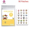 Springevenstar Miếng Dán Chống Thấm Nước 96 Cái Giảm Mụn, Tẩy Mụn, Mặt Nạ Acne 6