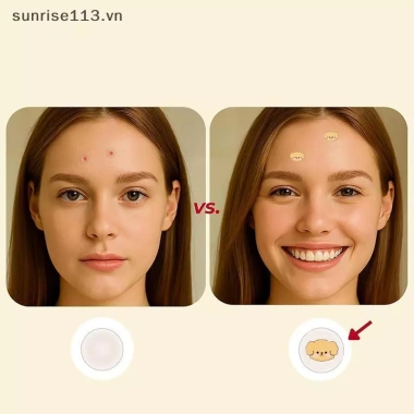 SR Beauty 100 miếng dán mụn không gây dị ứng, chống thấm nước, thiết kế hình chó dễ thương, giá chỉ 63.250₫ 5