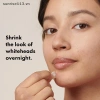 SR Beauty 192 miếng dán mụn vô hình - chăm sóc da, che khuyết điểm, giá 46,090đ 6