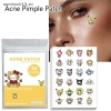 SR Beauty 96 miếng dán Acne Pimple chống thấm nước - giảm mụn nhanh, tẩy mụn, mặt nạ da - 59.200₫ 3