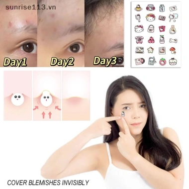 SR Beauty Patch Mụn Trứng Cá Chống Thấm Nước - Giảm Mụn Nhanh, Giá Ưu Đãi 55,400₫ 8