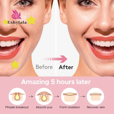 Star Pimple Patch 600 miếng – Miếng dán mụn vô hình, nhiều màu sắc, loại bỏ mụn, chăm sóc da – Giá ưu đãi 74.910₫ 5 Star Pimple Patch 600 miếng – Miếng dán mụn vô hình, nhiều màu sắc, loại bỏ mụn, chăm sóc da – Giá ưu đãi 74.910₫ 5