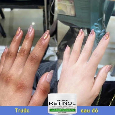 Sữa dưỡng thể trắng da tay, làm sáng melanin, giữ ẩm – Giá chỉ 136k VND, dưỡng trắng toàn thân 3