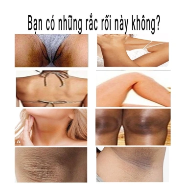 Sữa dưỡng thể trắng da tay, làm sáng melanin, giữ ẩm – Giá chỉ 136k VND, dưỡng trắng toàn thân 4