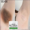 Sữa dưỡng thể trắng da tay, làm sáng melanin, giữ ẩm – Giá chỉ 136k VND, dưỡng trắng toàn thân 6