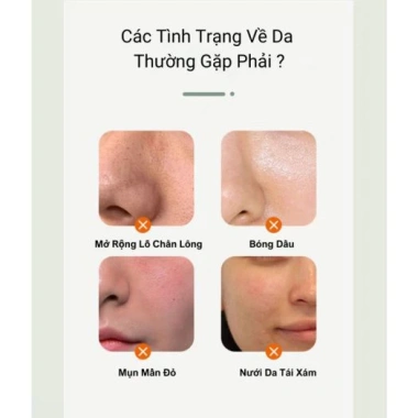 Sữa rửa mặt đất sét YINBA giảm mụn đầu đen, tạo bọt kiềm dầu, làm sâu, da mịn màng, dưỡng ẩm - 125k 7