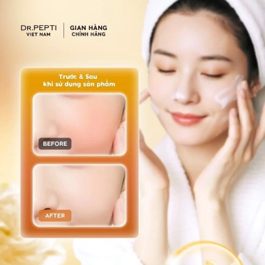 Sữa Rửa Mặt Tạo Bọt Dr.Pepti Galacto Cleansing Foam 110ml – Da Sáng Mịn, Làm Sạch Sâu, Giá 199k 3 Sữa Rửa Mặt Tạo Bọt Dr.Pepti Galacto Cleansing Foam 110ml – Da Sáng Mịn, Làm Sạch Sâu, Giá 199k 3