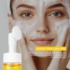 Sữa rửa mặt tạo bọt nghệ Lakerain 100ml làm sạch sâu, tẩy tế bào chết nhẹ, kiểm soát mụn 3