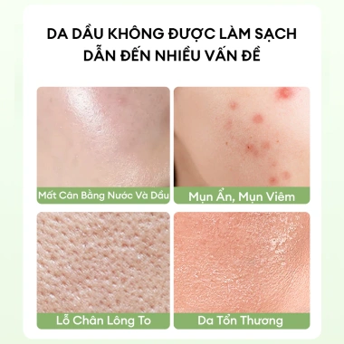 Sữa Rửa Mặt Trà Xanh ColorKey Luminous 100g - Loại Bỏ Dầu Nhờn, Không Khô Da, Giá 152k