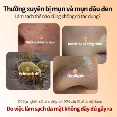 Sữa Rửa Mặt Vitamin C Niacinamide Kangyan 50g - Se Lỗ Chân Lông, Sạch Sâu, 249k