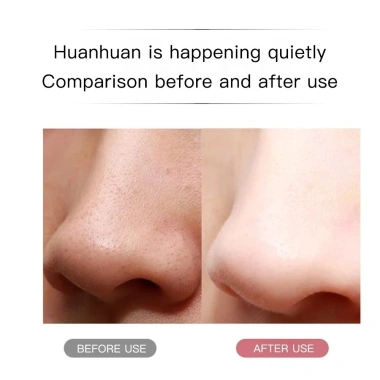 Sữa rửa mặt YUNAFIN, Máy chà sàn da siêu âm Ion sạc lại, máy tẩy đầu đen rung sâu di động, Giá chỉ 128.810₫
