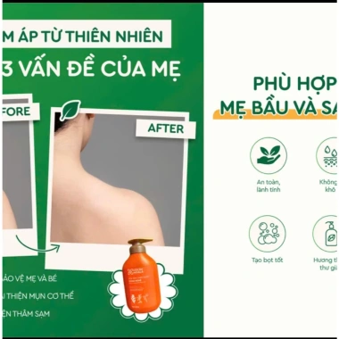 Sữa tắm Gừng Nghệ Natural Organic cho mẹ bầu giữ ấm cơ thể mùa lạnh - 258.750₫ 8 Sữa tắm Gừng Nghệ Natural Organic cho mẹ bầu giữ ấm cơ thể mùa lạnh - 258.750₫ 8