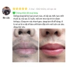 Sủi Thải Độc SHUI MU - Hút Sạch Tế Bào Sừng, Bụi Bẩn, Bọt Tẩy Tế Bào Chết, Dưỡng Da Trắng Sáng, Giá 239.000₫ 5
