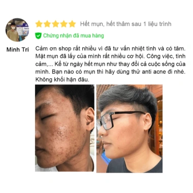 Sủi Thải Độc SHUI MU - Hút Sạch Tế Bào Sừng, Bụi Bẩn, Bọt Tẩy Tế Bào Chết, Dưỡng Da Trắng Sáng, Giá 239.000₫
