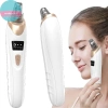 Sund Máy Tẩy Mụn Đầu Đen Điện Tử - Hút Bụi, Loại Điểm Đen, Sạch Sâu Lỗ Chân Lông, 130.240₫ 2