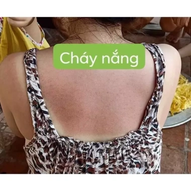 Tắm Trắng Men Bia 3-5 Tone Ngay Lần Đầu - Giá Gốc 217k Giảm còn 175k - Da Sáng Tự Nhiên, Dưỡng Ẩm, An Toàn
