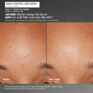 Tẩy da chết Dermalogica Daily Microfoliant cám gạo 13g - Giá 580.000đ, giảm 139.200đ
