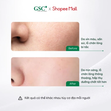 Tẩy Da Chết Sinh Học GSC Natural Peeling – Sạch Nhẹ Nhàng, Không Bào Mòn, 475k 7 Tẩy Da Chết Sinh Học GSC Natural Peeling – Sạch Nhẹ Nhàng, Không Bào Mòn, 475k 7