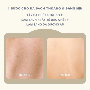 Tẩy Tế Bào Chết 3 Trong 1 Da Nhạy Cảm - Làm Sạch Sâu, Dưỡng Ẩm, Công Thức Dịu Nhẹ, Giá 138k 4