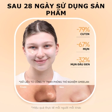 Tẩy Tế Bào Chết AILIYA Dưỡng Ẩm, Sâu Lỗ Chân Lông, Da Mặt Mịn Màng - 49.900₫