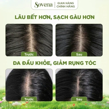 Tẩy tế bào chết da đầu muối Sovena làm sạch, loại bỏ bã nhờn, giảm bết dầu 280.000 VND 6