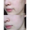 Tẩy tế bào chết da mặt Arrahan Peelling Gel Hàn Quốc 180ml - Da mịn màng, giảm giá 74k 4