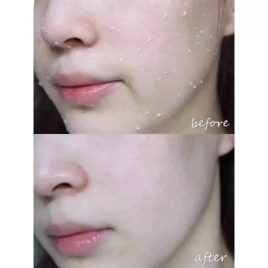 Tẩy tế bào chết da mặt Arrahan Peelling Gel Hàn Quốc 180ml - Da mịn màng, giảm giá 74k 4
