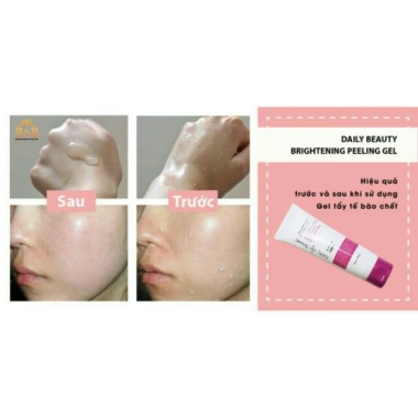 Tẩy tế bào chết Daily Beauty Brightening Pelling Gel - Sạch nhẹ, se lỗ chân lông, giá ưu đãi 340k