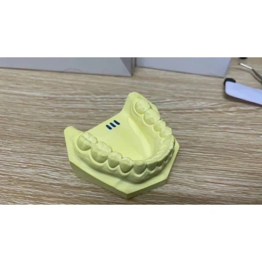 Thạch cao vàng Đổ mẫu răng Type III, IV - Túi 1kg, chỉ 45.000đ, chất lượng cao, dễ thi công 2