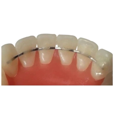 Thanh duy trì cố định sau chỉnh nha - Túi 2 dây hàm trên hàm dưới, thanh dẹt & xoắn 10 dây, 90.000₫ 3