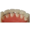 Thanh duy trì cố định sau chỉnh nha - Túi 2 dây hàm trên hàm dưới, thanh dẹt & xoắn 10 dây, 90.000₫ 4