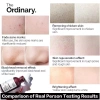 The Ordinary AHA 30% + BHA 2% Peeling 30ml - Tẩy chết, giảm mụn thâm, da sáng 198k 4