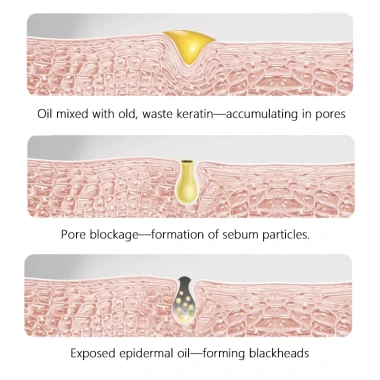 The Ordinary AHA 30% + BHA 2% Peeling 30ml - Tẩy chết, giảm mụn thâm, da sáng 198k