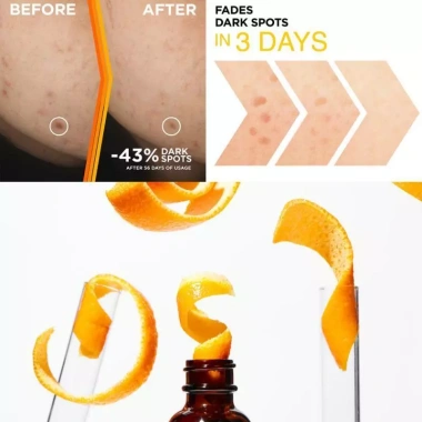 The Ordinary Ascorbic Acid Serum Vitamin C - Trị Thâm, Làm Trắng, Dưỡng Ẩm Da Mặt - Giá 174.255 VND 3 The Ordinary Ascorbic Acid Serum Vitamin C - Trị Thâm, Làm Trắng, Dưỡng Ẩm Da Mặt - Giá 174.255 VND 3
