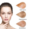 The Ordinary Ascorbic Acid Serum Vitamin C - Trị Thâm, Làm Trắng, Dưỡng Ẩm Da Mặt - Giá 174.255 VND 5