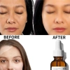 The Ordinary Ascorbic Acid Serum Vitamin C - Trị Thâm, Làm Trắng, Dưỡng Ẩm Da Mặt - Giá 174.255 VND 7