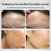 The Ordinary Glycolic Acid 7% Toner tẩy da chết cho da dầu mụn - Chính hãng, giảm giá 257.999₫ 5