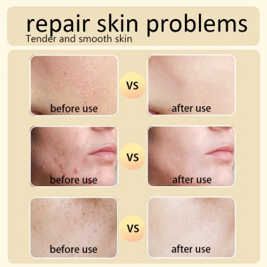 The Ordinary Glycolic Acid 7% Toner tẩy da chết cho da dầu mụn - Chính hãng, giảm giá 257.999₫