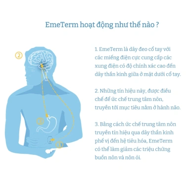 Thiết bị đeo tay chống nôn ói EmeTerm Fashion FDA/CE không dùng thuốc giảm 22% 3 Thiết bị đeo tay chống nôn ói EmeTerm Fashion FDA/CE không dùng thuốc giảm 22% 3