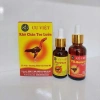 Thực phẩm dinh dưỡng gà chiến khô chân teo lườn ƯU VIỆT bộ 2 chai 100.000đ