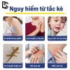 Thuốc diệt thằn lằn an toàn cho người và thú cưng - 30 năm không còn thằn lằn, giá 62.999 2
