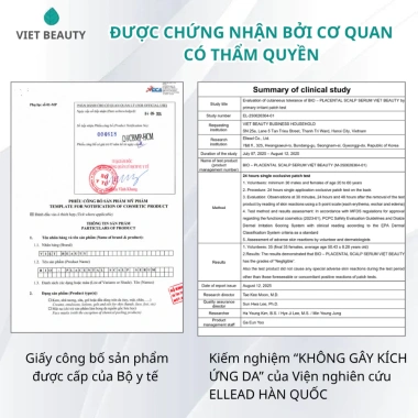 Tinh chất Bio-Placental Scalp Serum VIETBEAUTY - Dưỡng nang tóc, tăng mật độ, giảm rụng tóc - Chỉ 135.000₫